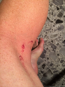 bleeding, iPhone, legs, shaved